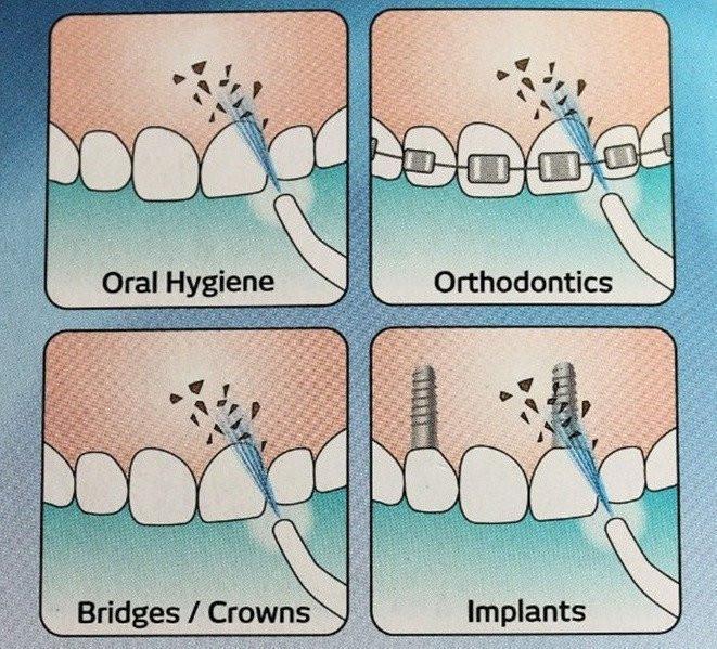 Doctor Hart's Power Floss - The Best  Solution for Flossing!
